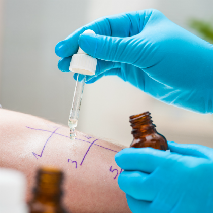 Alergias: ¿qué cubre el seguro de salud?